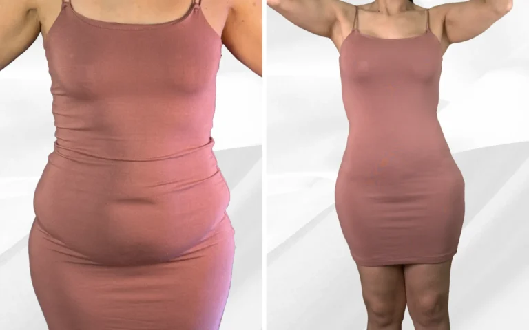 B&A Body Contouring