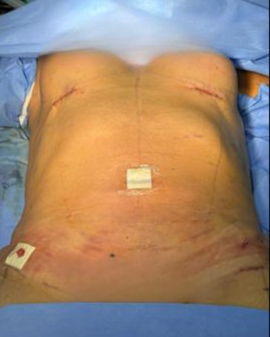 Body 12