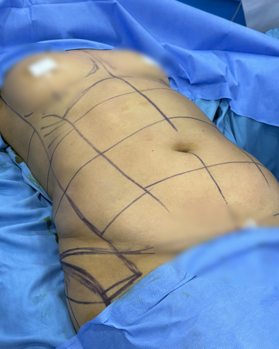 Body 9