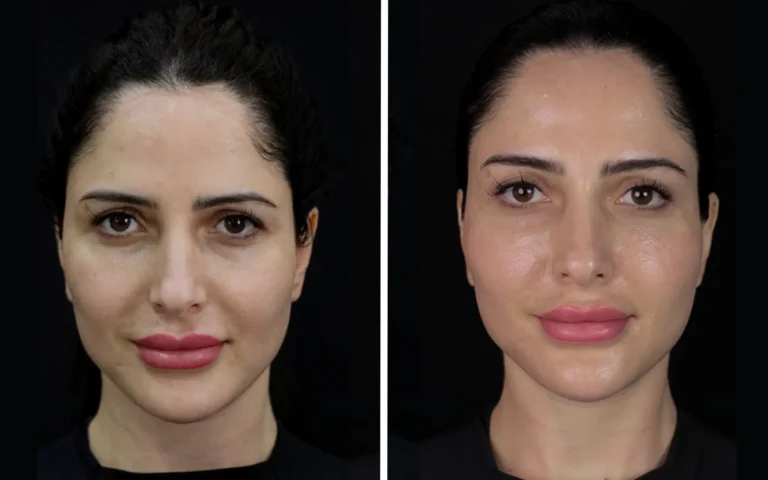 Face Treatments