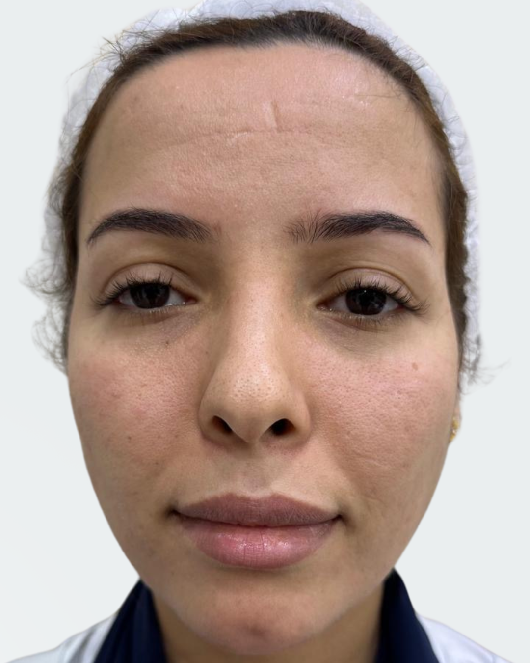 Full face 10