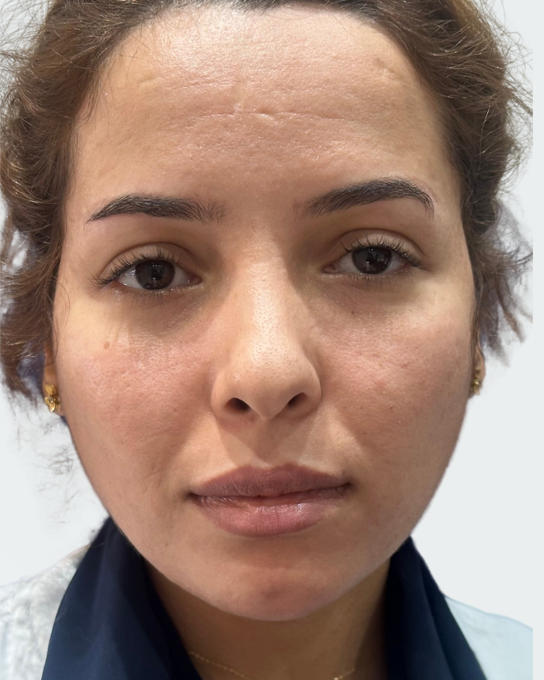Full face 17