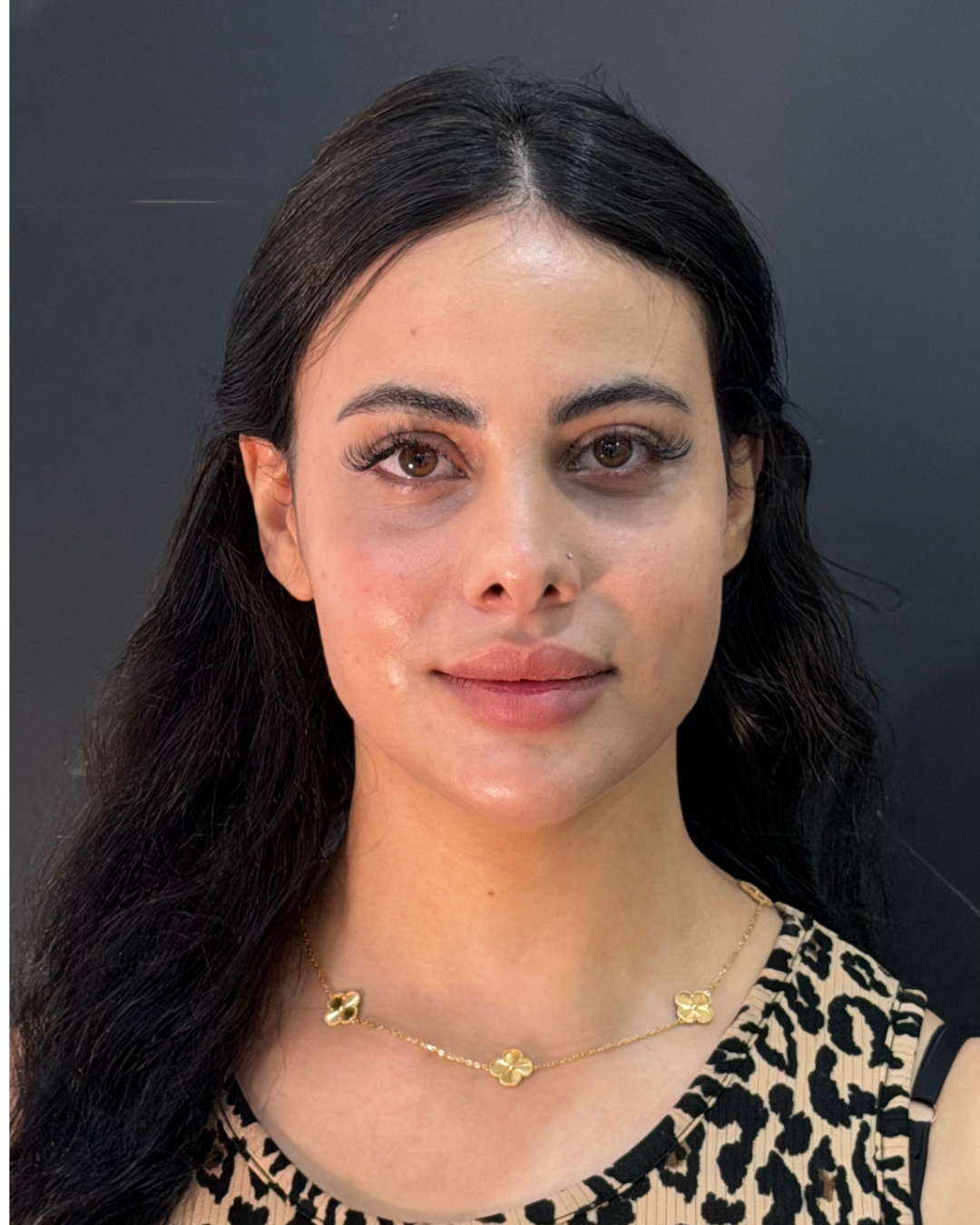 Full face after