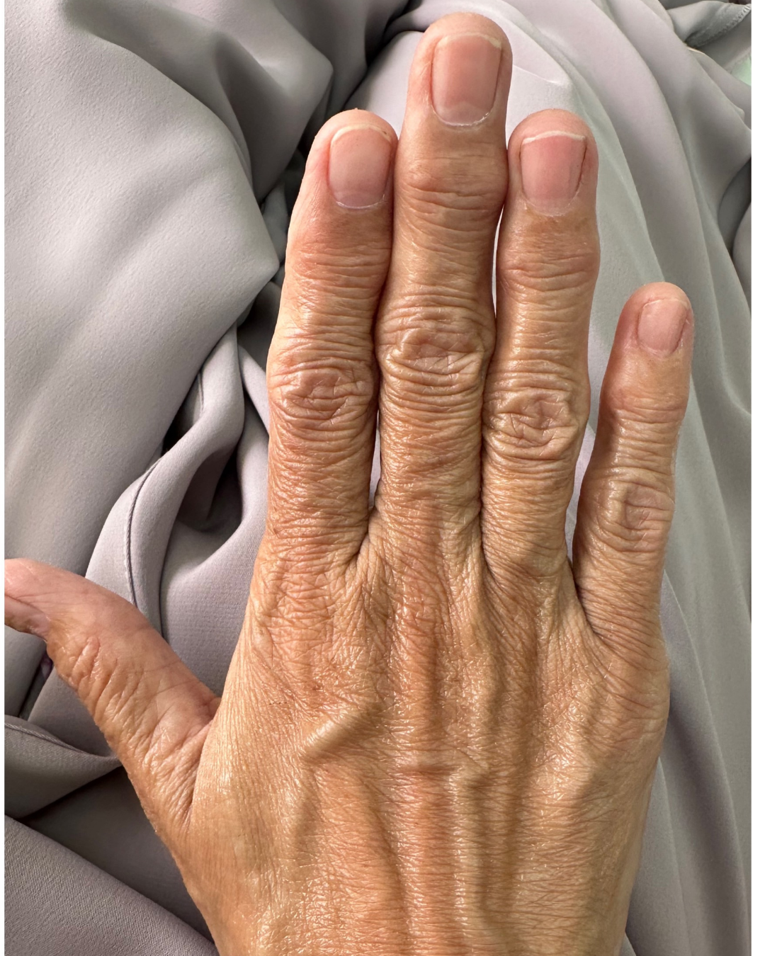 Hand filler 1