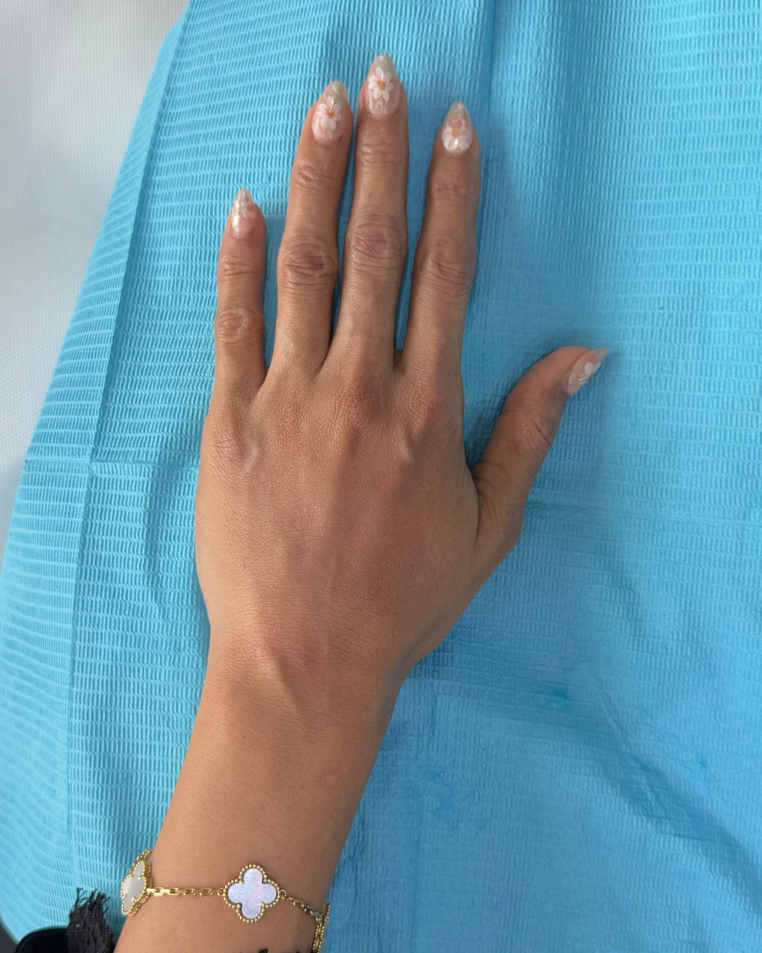 Hand filler 10