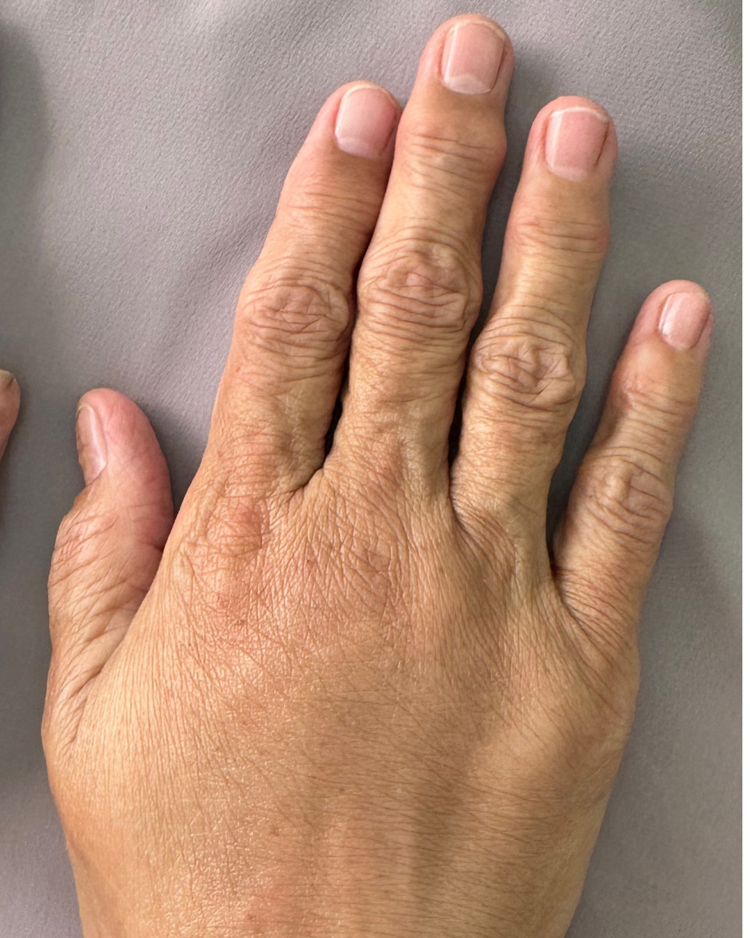 Hand filler 2