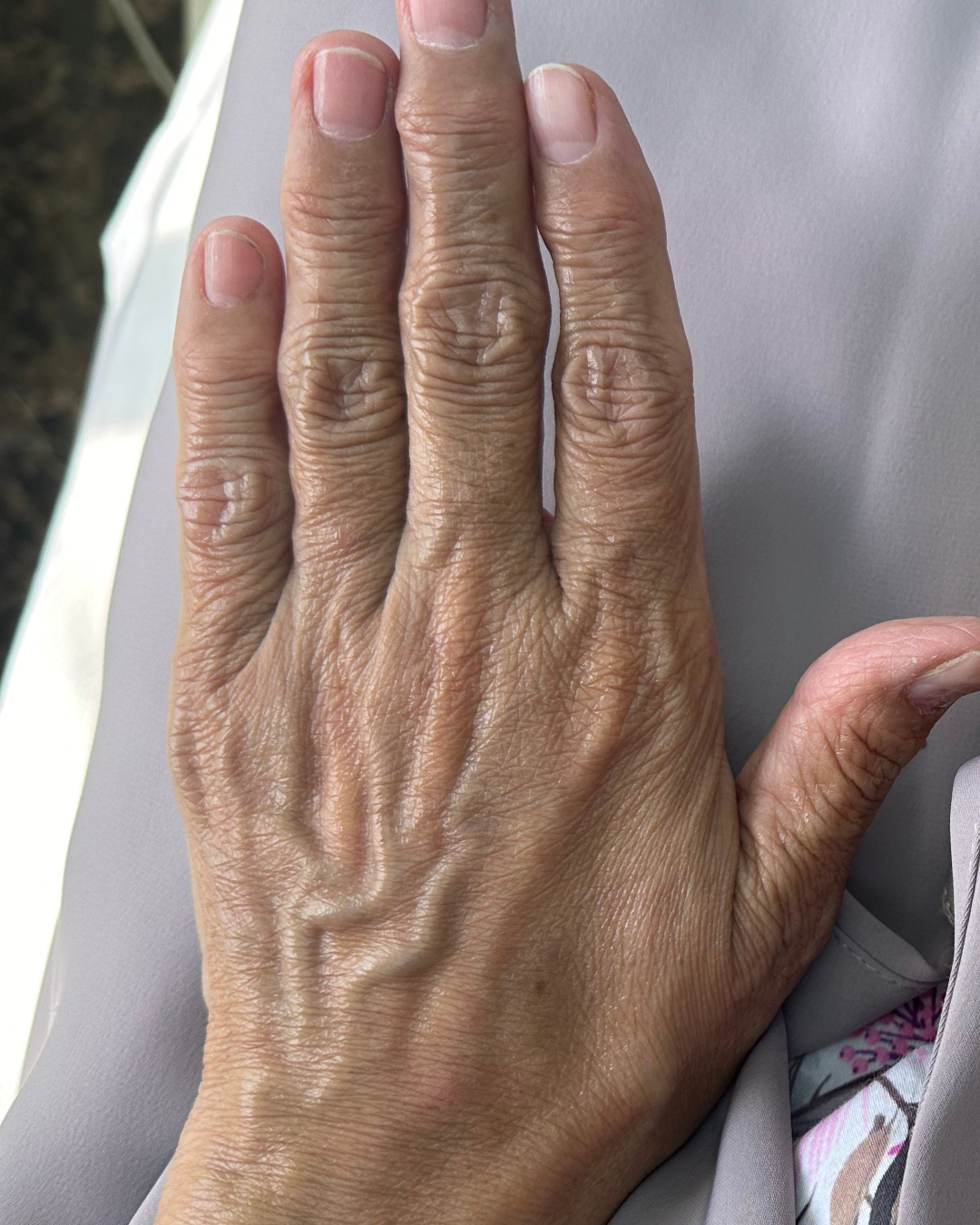 Hand filler 3