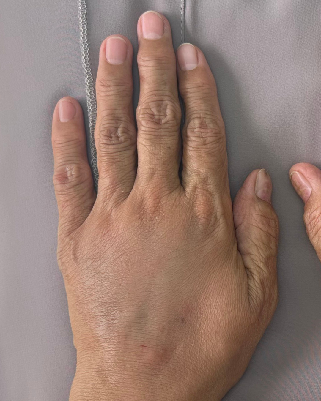 Hand filler 4