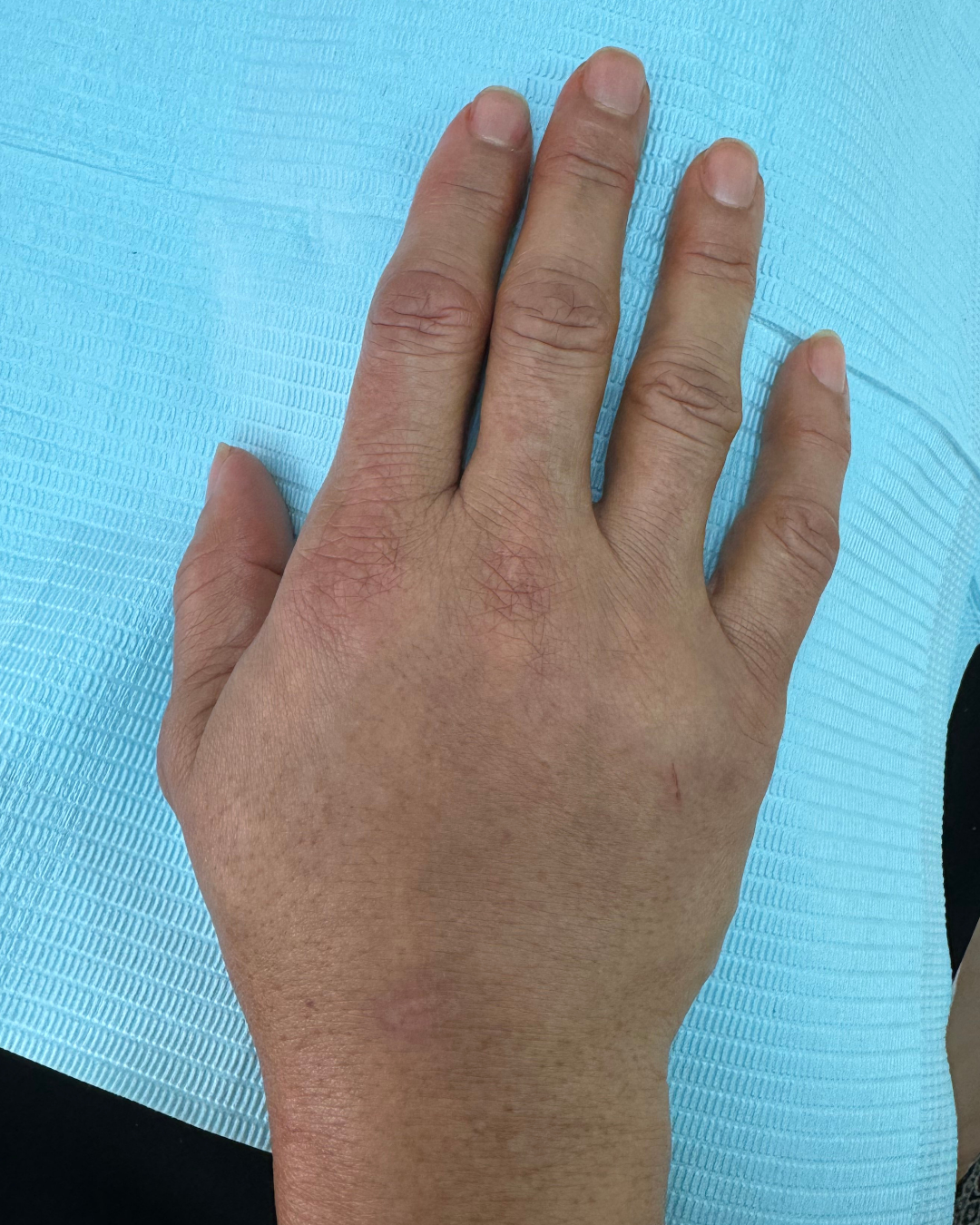Hand filler 6