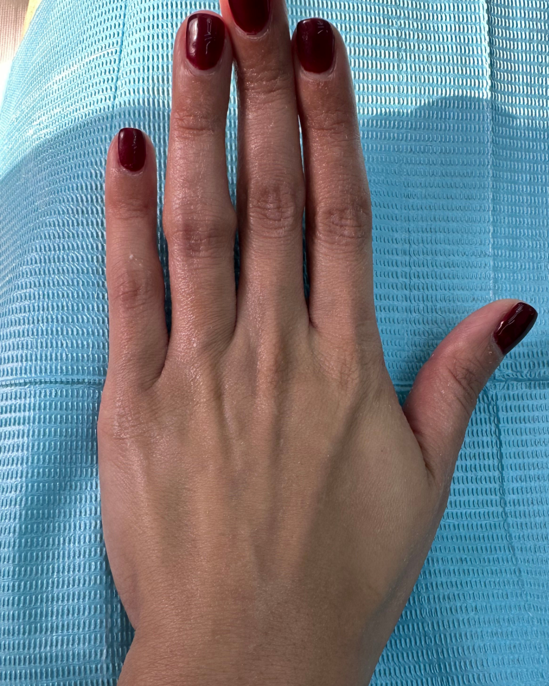 Hand filler 7