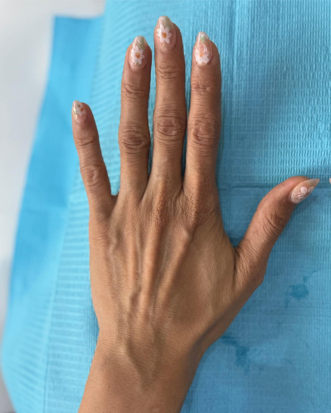 Hand filler 9