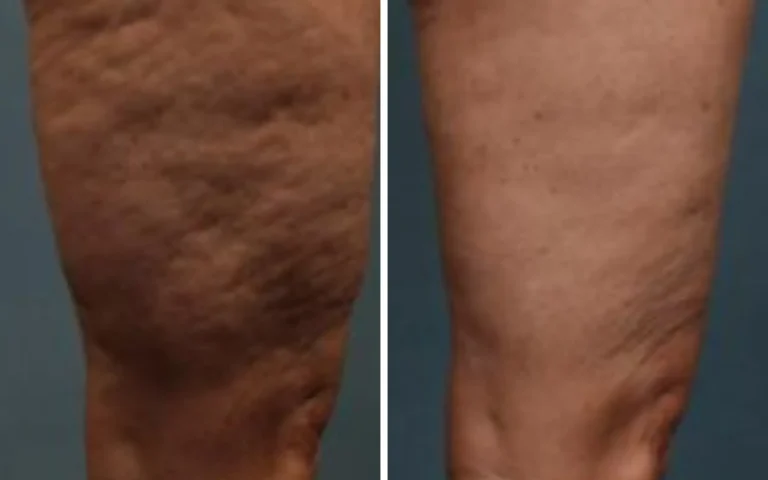 body treatments b&a